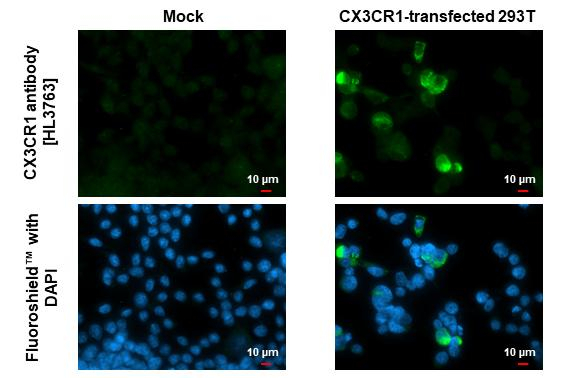 CX3CR1 Antibody in Immunocytochemistry (ICC/IF)