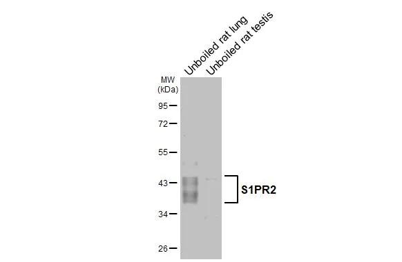 S1PR2 Antibody in Western Blot (WB)