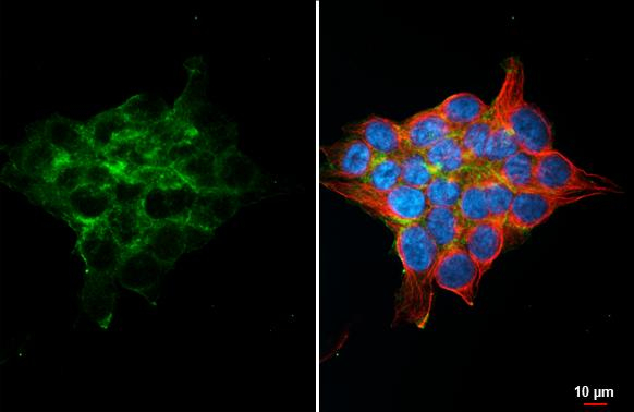 PAR2 Antibody in Immunocytochemistry (ICC/IF)