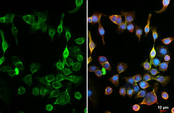 GPR30 Antibody in Immunocytochemistry (ICC/IF)