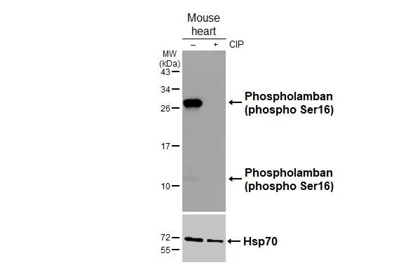 Phospho-Phospholamban (Ser16) Antibody in Western Blot (WB)