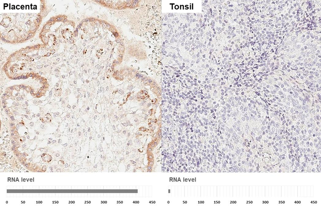 VEGF Receptor 1 Antibody in Immunohistochemistry (Paraffin) (IHC (P))