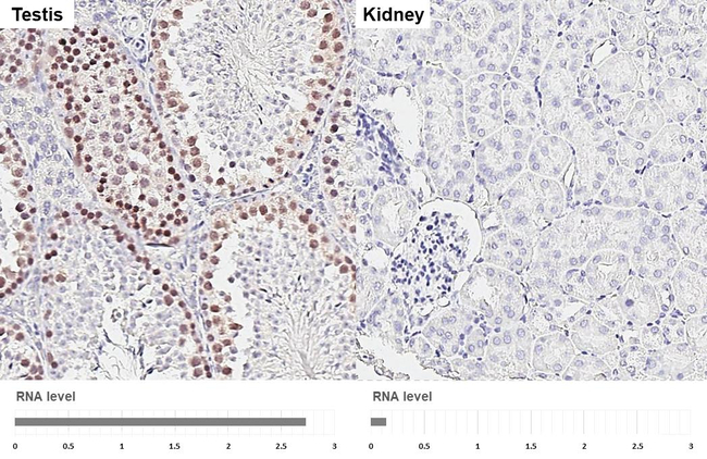 RAD51 Antibody in Immunohistochemistry (Paraffin) (IHC (P))