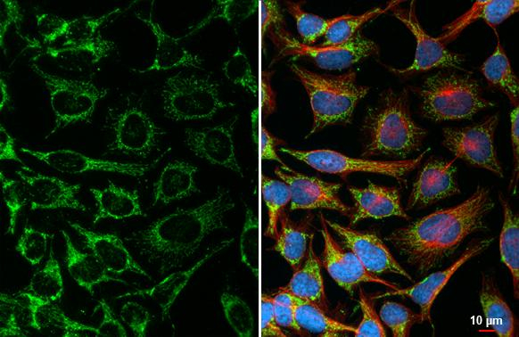 TRAP1 Antibody in Immunocytochemistry (ICC/IF)