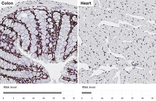 ALY Antibody in Immunohistochemistry (Paraffin) (IHC (P))
