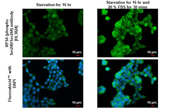 Phospho-S6 (Ser240, Ser244) Antibody in Immunocytochemistry (ICC/IF)