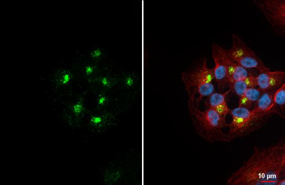 VIP Antibody in Immunocytochemistry (ICC/IF)