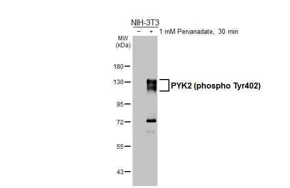 Phospho-PYK2 (Tyr402) Antibody in Western Blot (WB)