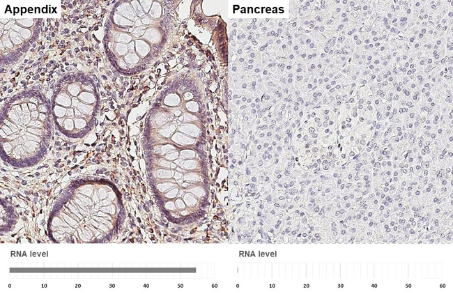 CXCL10 Antibody in Immunohistochemistry (Paraffin) (IHC (P))