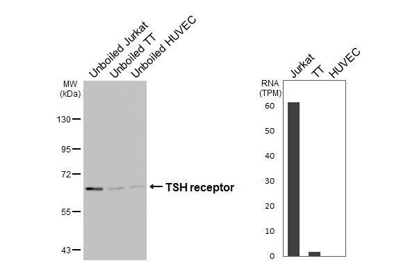 TSH Receptor Antibody in Western Blot (WB)