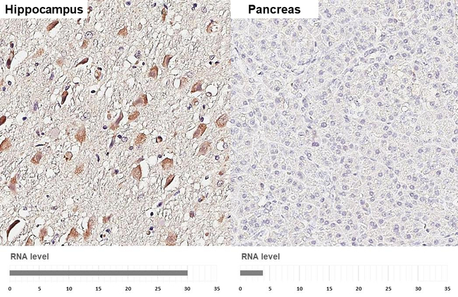 HTR1E Antibody in Immunohistochemistry (Paraffin) (IHC (P))
