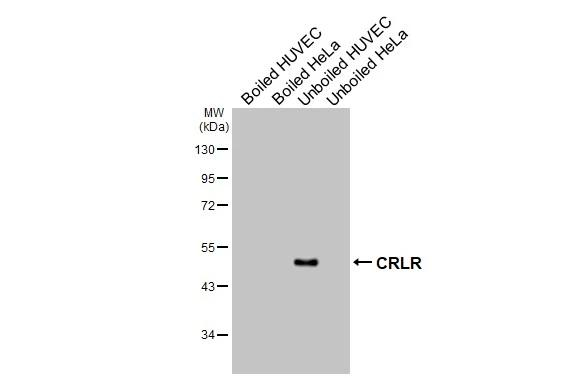CALCRL Antibody in Western Blot (WB)