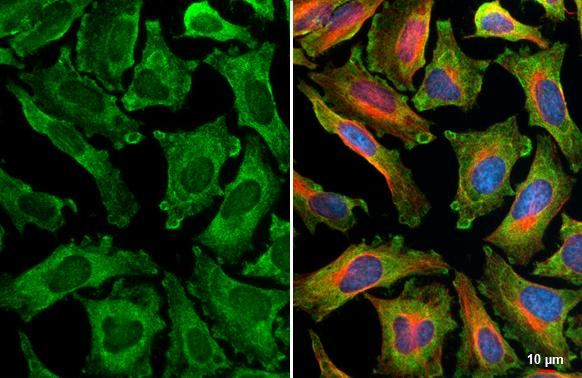 TRAF6 Antibody in Immunocytochemistry (ICC/IF)