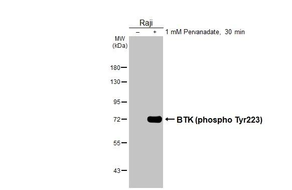 Phospho-BTK (Tyr223) Antibody in Western Blot (WB)