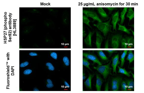 Phospho-HSP27 (Ser82) Antibody in Immunocytochemistry (ICC/IF)
