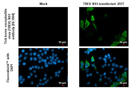 Tick-Borne Encephalitis Virus NS1 Antibody in Immunocytochemistry (ICC/IF)