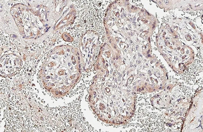 Angiopoietin 2 Antibody in Immunohistochemistry (Paraffin) (IHC (P))