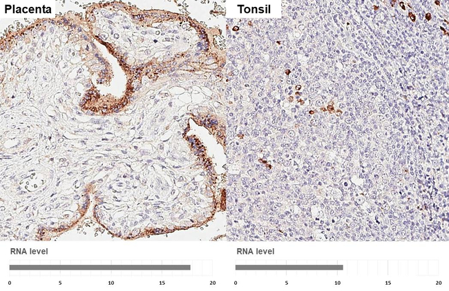 S1PR2 Antibody in Immunohistochemistry (Paraffin) (IHC (P))