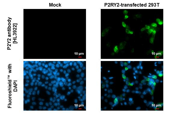 P2Y2 Antibody in Immunocytochemistry (ICC/IF)