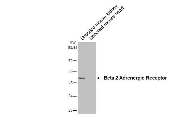 beta-2 Adrenergic Receptor Antibody in Western Blot (WB)