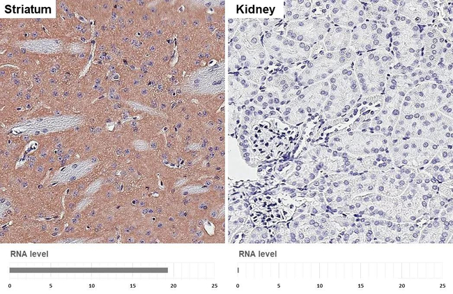 CHRM1 Antibody in Immunohistochemistry (Paraffin) (IHC (P))