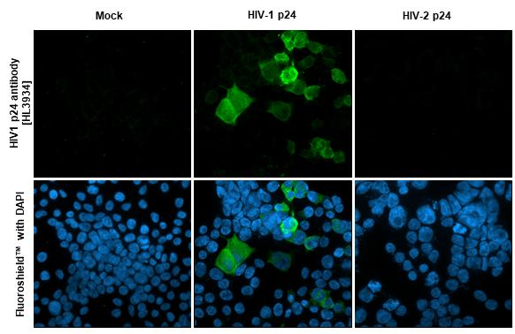 HIV1 p24 Antibody in Immunocytochemistry (ICC/IF)