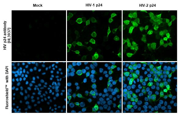 HIV1/2 p24 Antibody in Immunocytochemistry (ICC/IF)