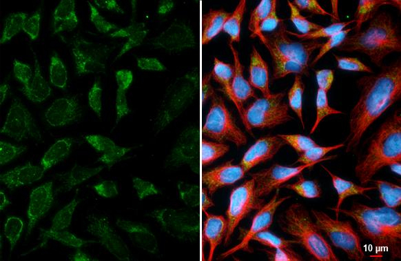 ATP Synthase gamma Antibody in Immunocytochemistry (ICC/IF)