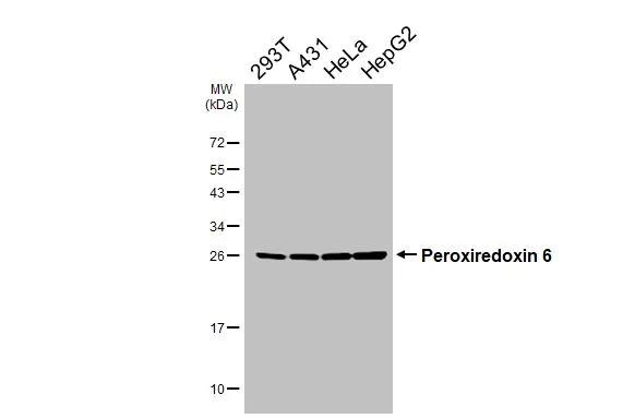 PRDX6 Antibody in Western Blot (WB)