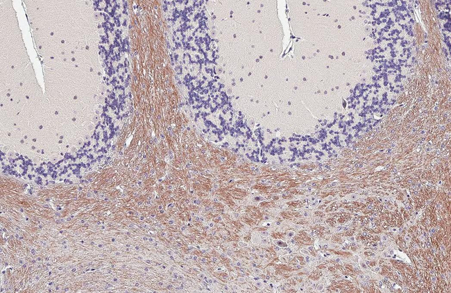 GPR40 Antibody in Immunohistochemistry (Paraffin) (IHC (P))