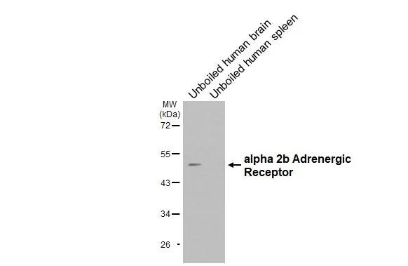 alpha-2b Adrenergic Receptor Antibody in Western Blot (WB)
