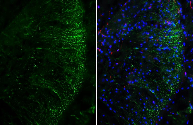 ADORA2B Antibody in Immunohistochemistry (Frozen) (IHC (F))