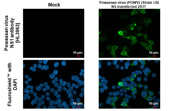 Powassan Virus NS1 Antibody in Immunocytochemistry (ICC/IF)