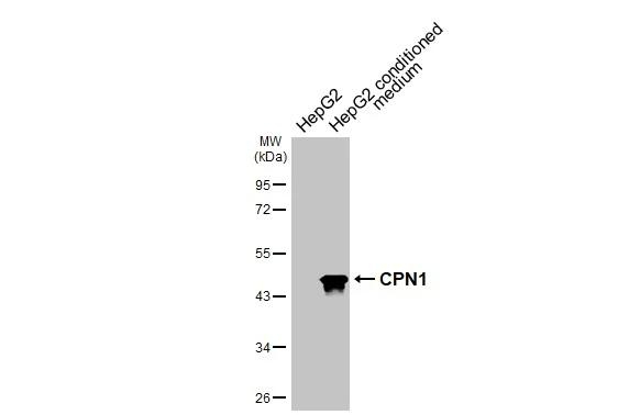 CPN1 Antibody in Western Blot (WB)