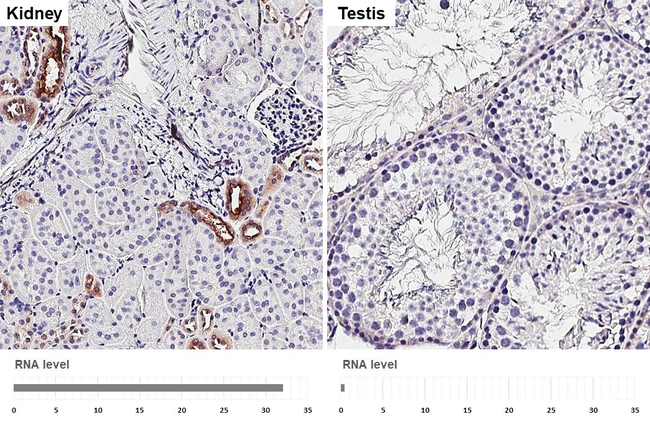 alpha-ENaC Antibody in Immunohistochemistry (Paraffin) (IHC (P))