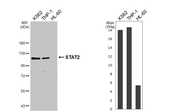 STAT2 Antibody in Western Blot (WB)