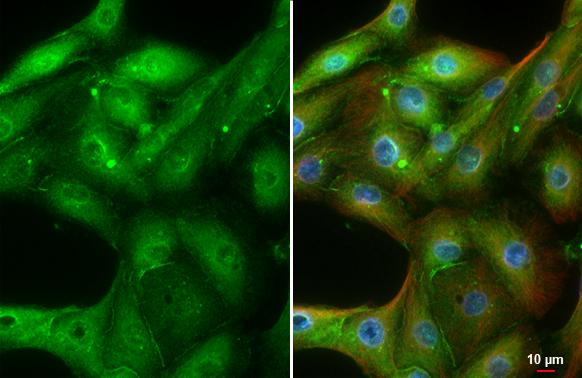 ADORA1 Antibody in Immunocytochemistry (ICC/IF)