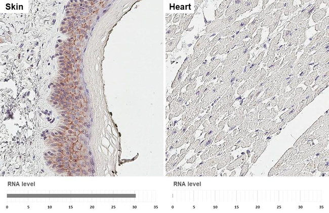 Nectin 4 Antibody in Immunohistochemistry (Paraffin) (IHC (P))