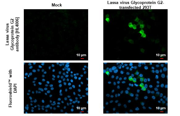 Lassa Virus Glycoprotein G2 Antibody in Immunocytochemistry (ICC/IF)