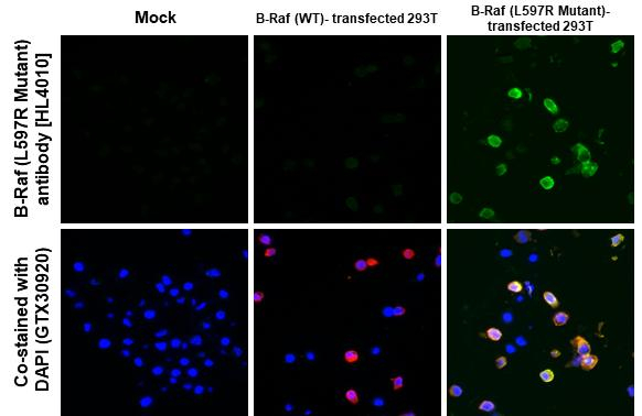 B-Raf (L597R Mutant) Antibody in Immunohistochemistry (Paraffin) (IHC (P))