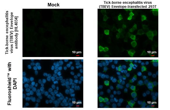 Tick-Borne Encephalitis Virus Envelope Antibody in Immunocytochemistry (ICC/IF)