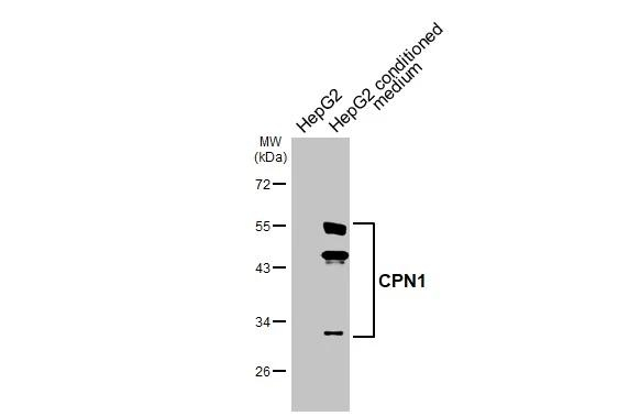 CPN1 Antibody in Western Blot (WB)