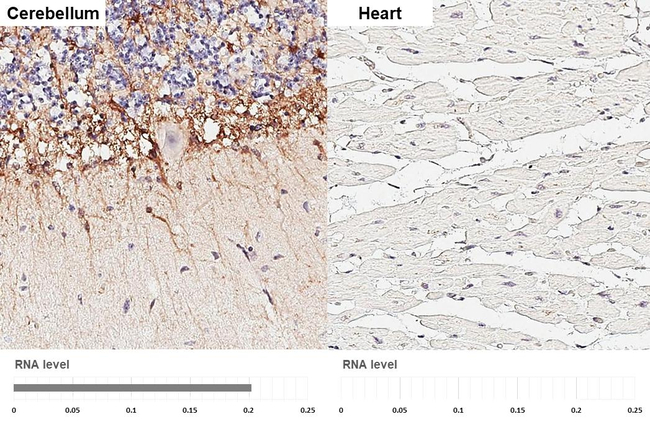 KISS1R Antibody in Immunohistochemistry (Paraffin) (IHC (P))