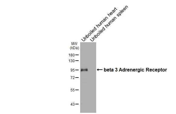 beta-3 Adrenergic Receptor Antibody in Western Blot (WB)