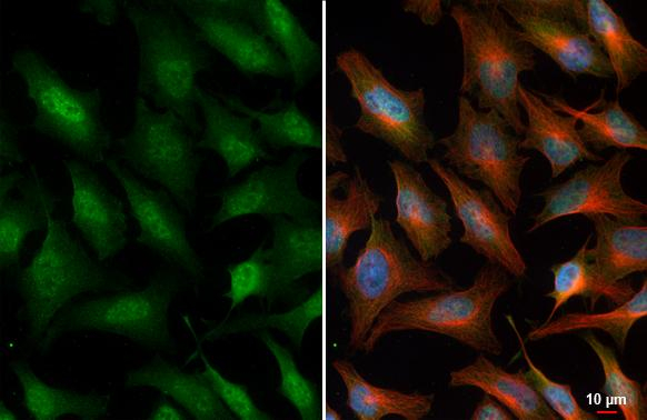 SLBP Antibody in Immunocytochemistry (ICC/IF)
