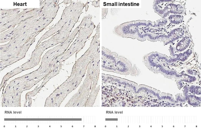 LPHN2 Antibody in Immunohistochemistry (Paraffin) (IHC (P))