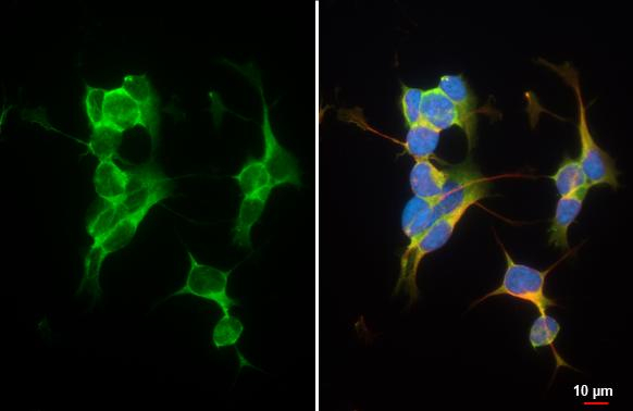 BAI3 Antibody in Immunocytochemistry (ICC/IF)
