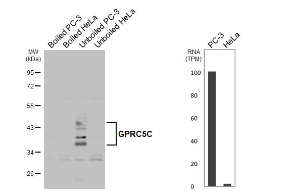 GPRC5C Antibody in Western Blot (WB)