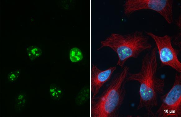 Ki-67 Antibody in Immunocytochemistry (ICC/IF)