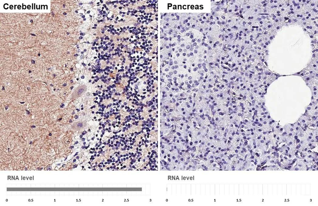 mGluR1 Antibody in Immunohistochemistry (Paraffin) (IHC (P))